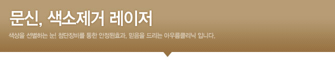 문신, 색소제거 레이저