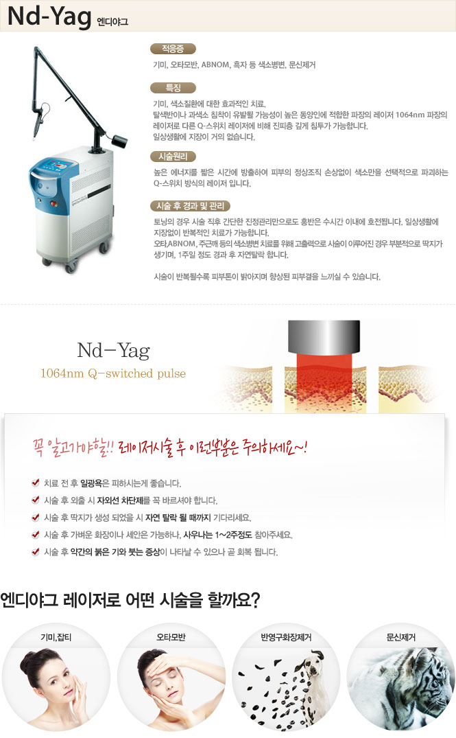 엔디야그 레이저