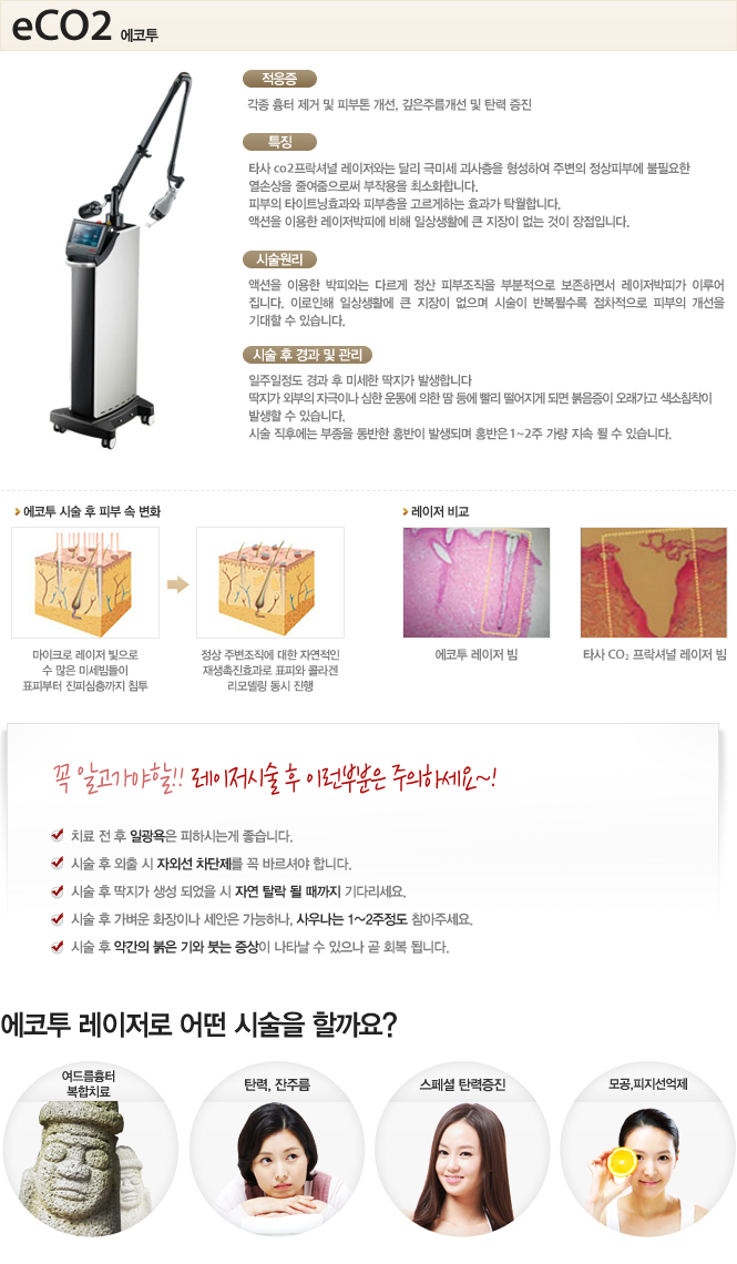 에코투 레이저