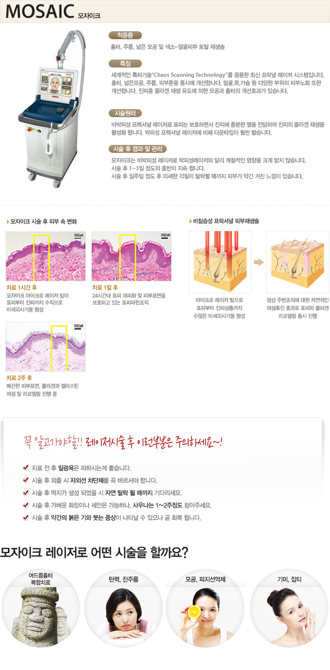 모자이크 레이저