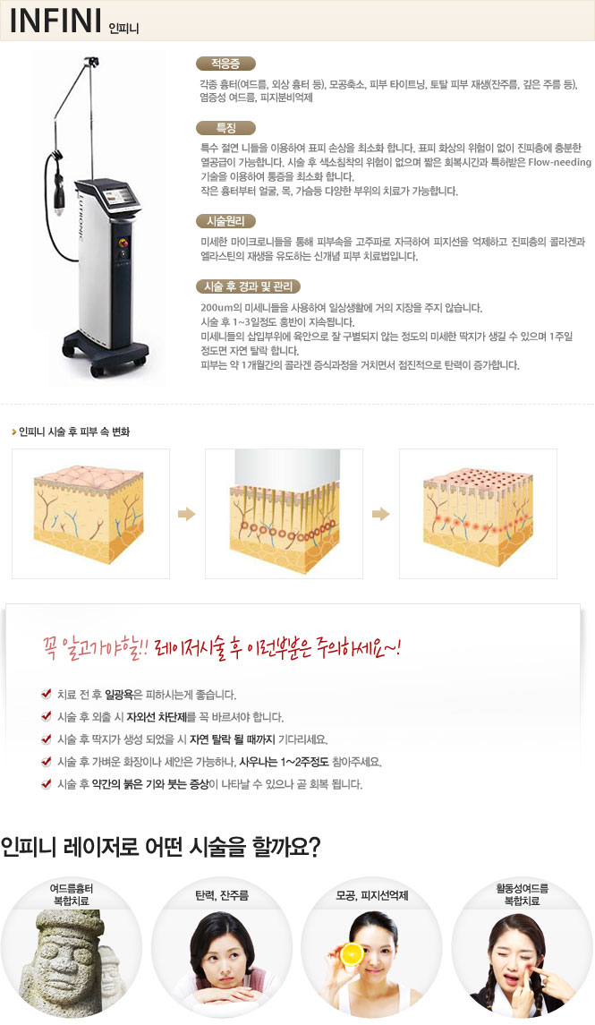 인피니 레이저
