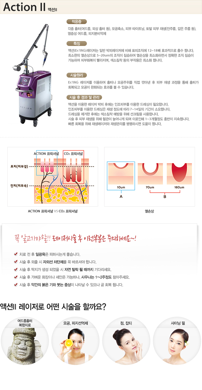 액션투 레이저