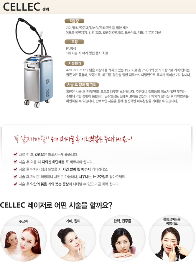 IPL 레이저