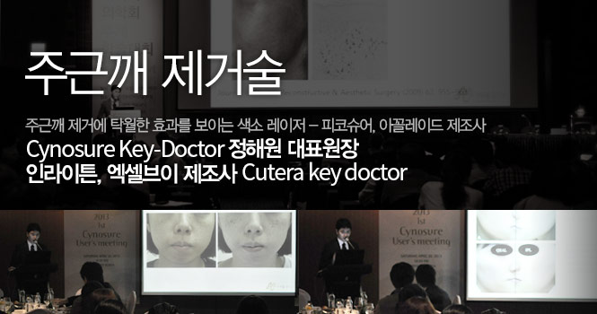 주근깨제거클리닉