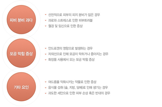 여드름의 원인