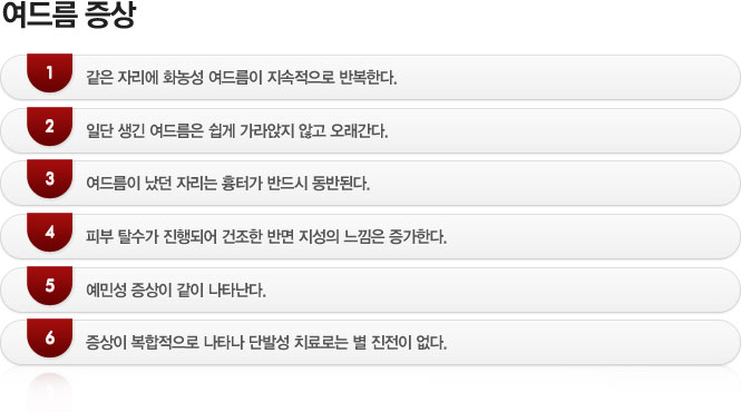 활동성 여드름 증상