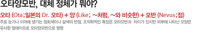 오타양모반, 대체 정체가 뭐야?