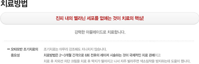 치료 방법