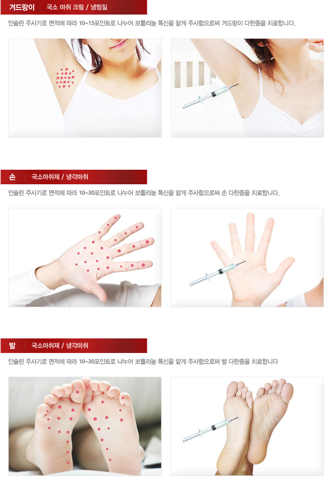 땀주사 시술 부위