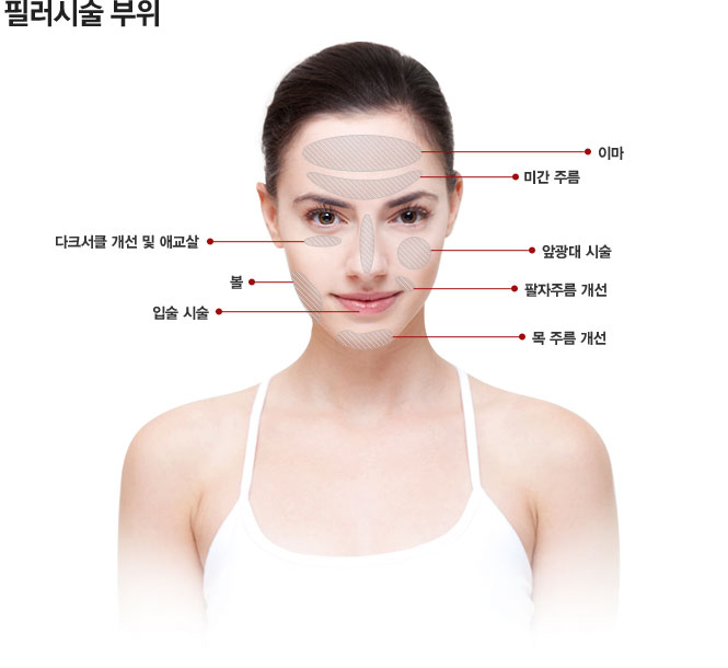 필러 시술 부위
