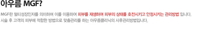 아우름MGF?
